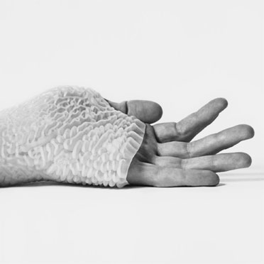 /assets/articles/2014/prosthetic-sockets-and-exoskeletons/l2_v354432_1200_372_372-4.jpg